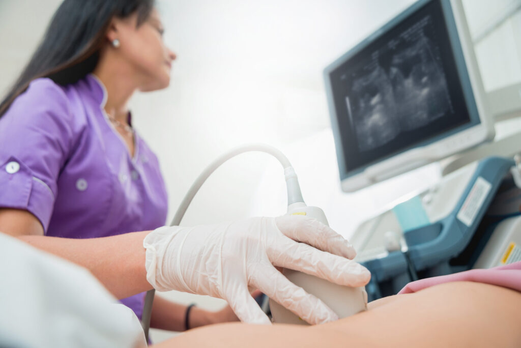 ultrasound tech salary
