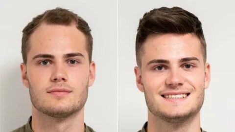 men's hair replacement systems